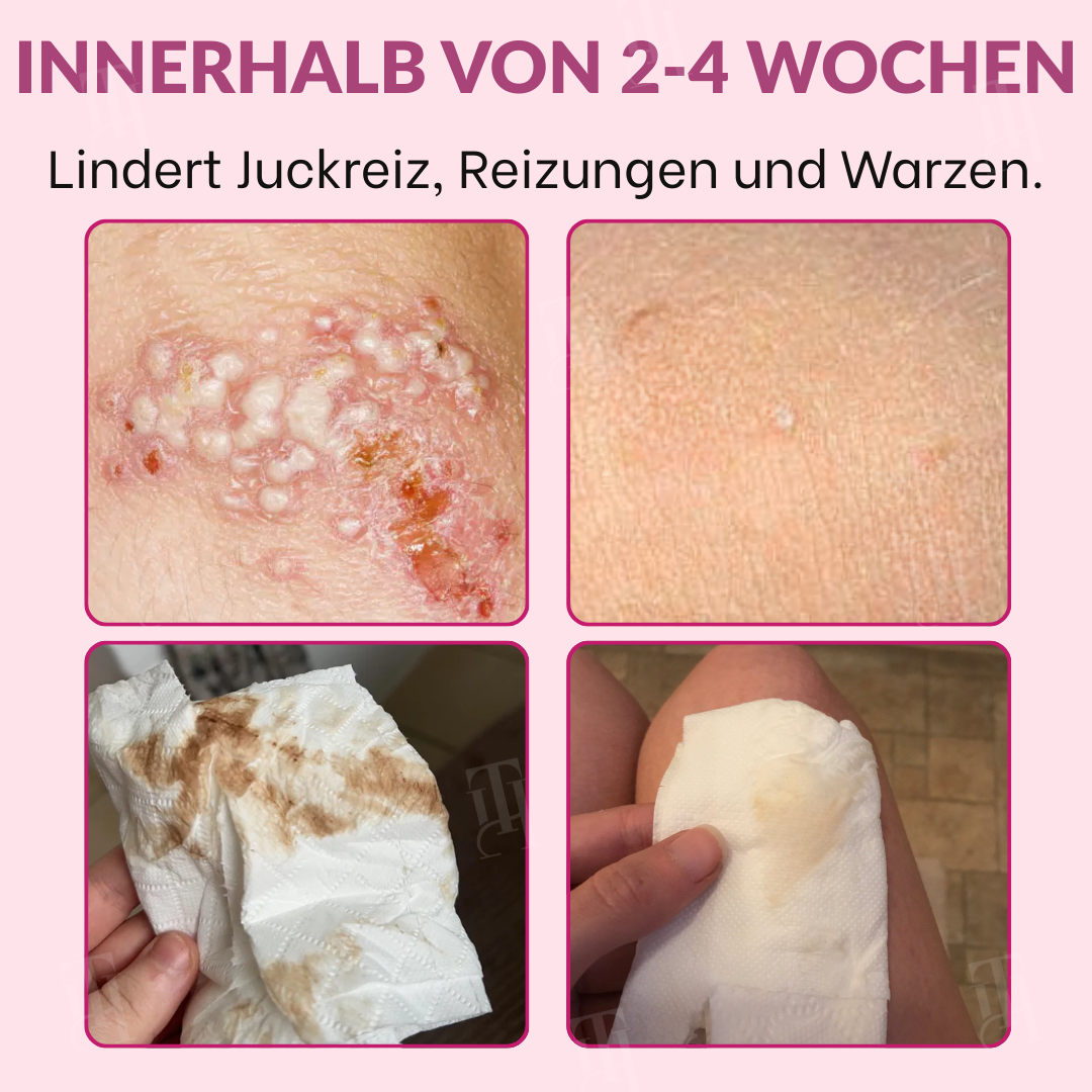 AEXZR® AB-Cyscare Anti-HPV vaginales Feuchtigkeitsgel🌸 Natürliche Intimgesundheit, die du spüren kannst