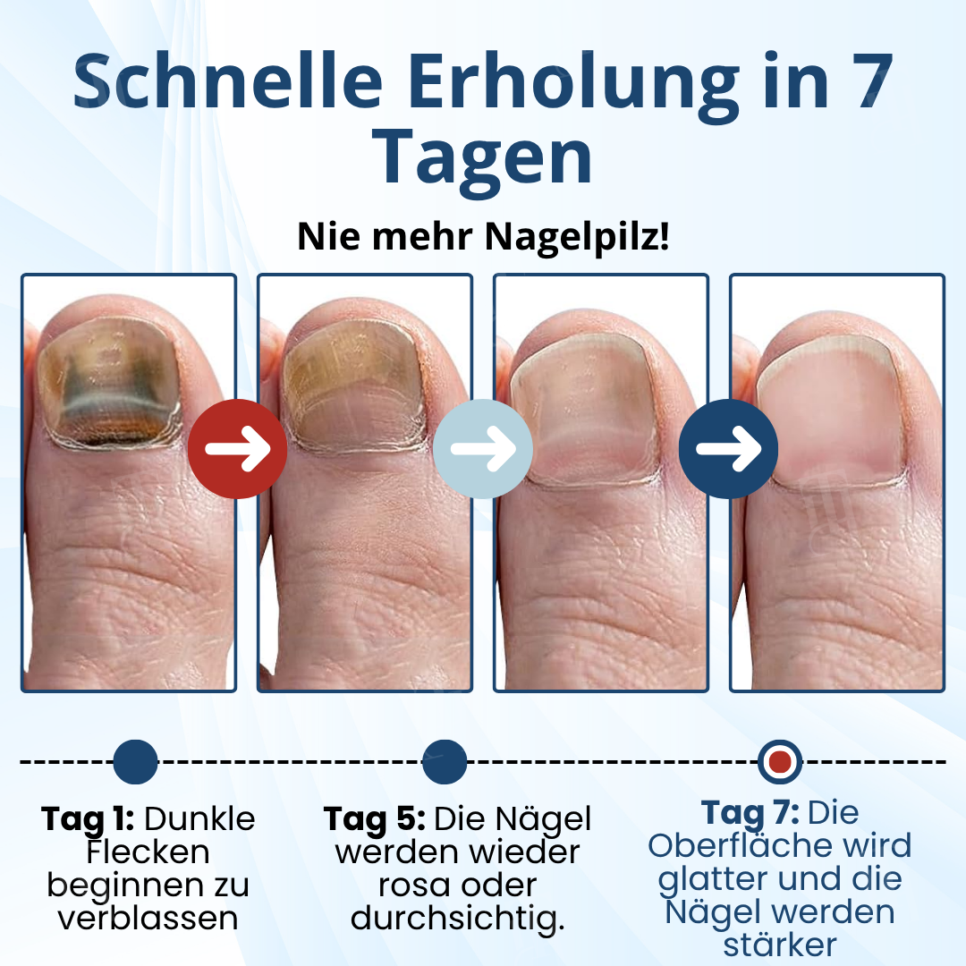 AEXZR® MycoShield Pro Pilznagelpflaster🌟 Durchbruch: Über Nacht zu stärkeren Nägeln