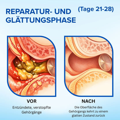 AEXZR® Squalan-Ohrreinigungs-Tropfen🔊 Endlich eine Ohrenpflege, die wirkt — sanft und tief
