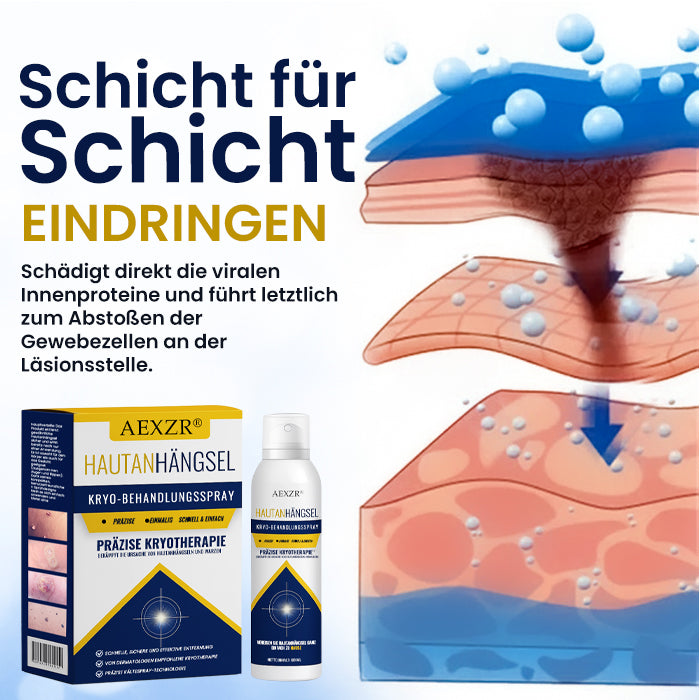 AEXZR® Hautanhängsel-Kryo-Behandlungsspray🧊 Präzisions-Kryotechnik: Vereist Stielwarzen & Warzen in Sekunden – Ohne Klingen, ohne Schmerzen.