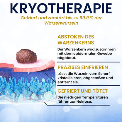 AEXZR® Hautanhängsel-Kryo-Behandlungsspray🧊 Präzisions-Kryotechnik: Vereist Stielwarzen & Warzen in Sekunden – Ohne Klingen, ohne Schmerzen.