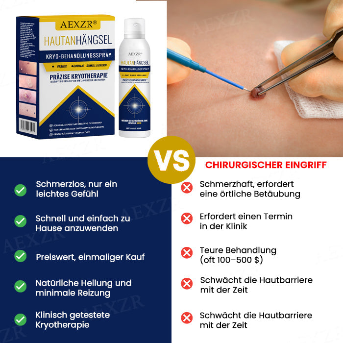 AEXZR® Hautanhängsel-Kryo-Behandlungsspray🧊 Präzisions-Kryotechnik: Vereist Stielwarzen & Warzen in Sekunden – Ohne Klingen, ohne Schmerzen.
