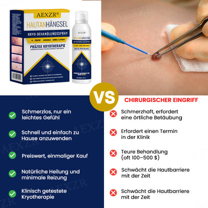 AEXZR® Hautanhängsel-Kryo-Behandlungsspray🧊 Präzisions-Kryotechnik: Vereist Stielwarzen & Warzen in Sekunden – Ohne Klingen, ohne Schmerzen.